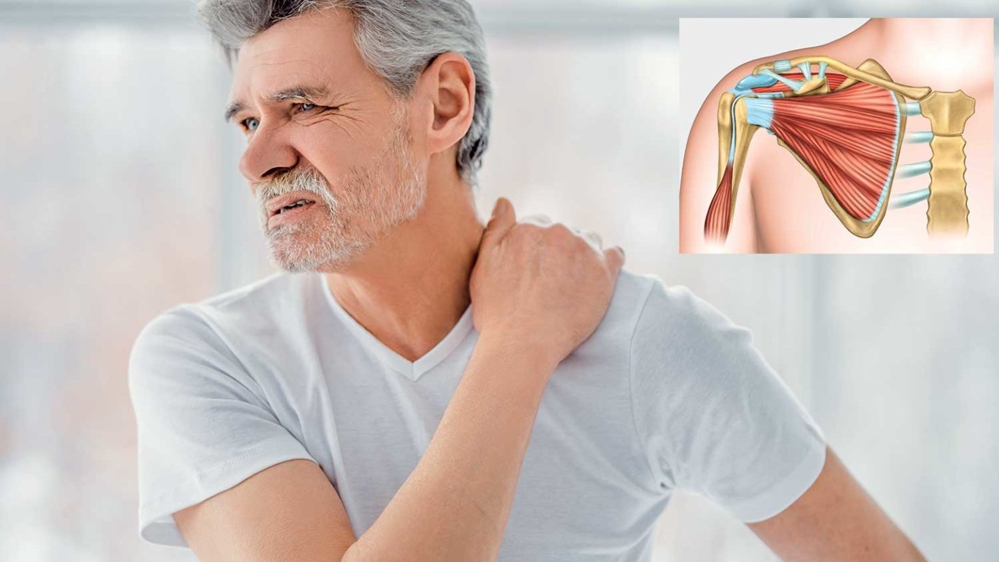 Que faire quand l'épaule fait mal? arthrose muscles