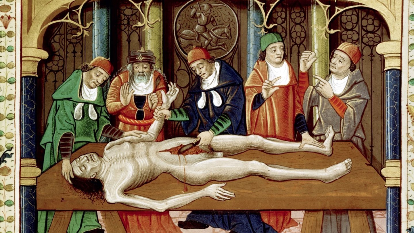 Représentation d'une dissection telle que pratiquée au XVe siècle en France. Chirurgie médecine légale don de son corps à la science